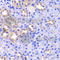 Thioredoxin Like 1 antibody, A6322, ABclonal Technology, Immunohistochemistry paraffin image 