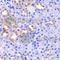 Thioredoxin-like protein 1 antibody, A6322, ABclonal Technology, Immunohistochemistry paraffin image 