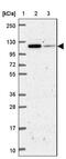 Insulin Degrading Enzyme antibody, NBP2-38994, Novus Biologicals, Western Blot image 