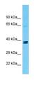 Transmembrane protein 236 antibody, orb327167, Biorbyt, Western Blot image 