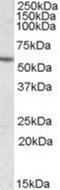 Carboxylesterase 1 antibody, NBP1-00167, Novus Biologicals, Western Blot image 