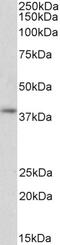 Casein Kinase 2 Beta antibody, 43-693, ProSci, Western Blot image 