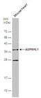 ADP-Ribosylhydrolase Like 1 antibody, GTX120706, GeneTex, Western Blot image 