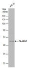 Platelet-activating factor acetylhydrolase antibody, GTX130757, GeneTex, Western Blot image 