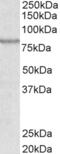 ATP Binding Cassette Subfamily B Member 5 antibody, AHP1667, Bio-Rad (formerly AbD Serotec) , Enzyme Linked Immunosorbent Assay image 