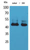 Serpin Family B Member 3 antibody, STJ96675, St John