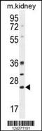 BCL10 Immune Signaling Adaptor antibody, MBS9205918, MyBioSource, Western Blot image 