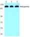 Progesterone Receptor antibody, A00541S294, Boster Biological Technology, Western Blot image 