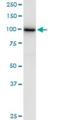 Glucosidase II Alpha Subunit antibody, H00023193-B01P, Novus Biologicals, Western Blot image 