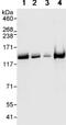 Kinesin Family Member 11 antibody, ab72413, Abcam, Western Blot image 