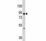 DNA Methyltransferase 3 Alpha antibody, F40604-0.4ML, NSJ Bioreagents, Western Blot image 