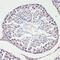 Microtubule Associated Protein 1 Light Chain 3 Alpha antibody, 14-019, ProSci, Immunofluorescence image 