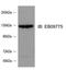 SLIT-ROBO Rho GTPase Activating Protein 2 antibody, NBP1-49877, Novus Biologicals, Western Blot image 