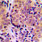 Eukaryotic Translation Initiation Factor 4E Binding Protein 1 antibody, LS-C353977, Lifespan Biosciences, Immunohistochemistry paraffin image 