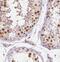 DEAH-Box Helicase 35 antibody, FNab02379, FineTest, Immunohistochemistry paraffin image 