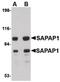 DLG Associated Protein 1 antibody, PA5-20531, Invitrogen Antibodies, Western Blot image 
