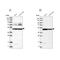 Hydroxyacyl-CoA Dehydrogenase Trifunctional Multienzyme Complex Subunit Beta antibody, NBP1-82609, Novus Biologicals, Western Blot image 