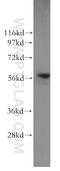 Prolyl 4-Hydroxylase Subunit Beta antibody, 11245-1-AP, Proteintech Group, Western Blot image 