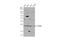 HRas Proto-Oncogene, GTPase antibody, GTX116041, GeneTex, Western Blot image 