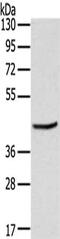 MAGE Family Member B3 antibody, CSB-PA225412, Cusabio, Western Blot image 