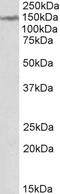 Lemur Tyrosine Kinase 2 antibody, STJ72351, St John