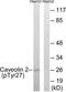 Caveolin 2 antibody, TA313185, Origene, Western Blot image 