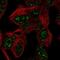 Ataxin 7 Like 3 antibody, NBP2-56183, Novus Biologicals, Immunocytochemistry image 