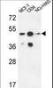 Sphingomyelin Synthase 2 antibody, LS-B9321, Lifespan Biosciences, Western Blot image 