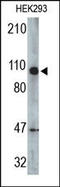 CYLD Lysine 63 Deubiquitinase antibody, 200136, Abbiotec, Western Blot image 