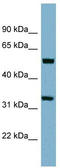 Transmembrane Protein 158 (Gene/Pseudogene) antibody, TA341978, Origene, Western Blot image 