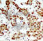 Ribosomal Protein S6 Kinase A1 antibody, AP0166, ABclonal Technology, Immunohistochemistry paraffin image 