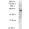 Potassium Voltage-Gated Channel Subfamily C Member 4 antibody, MA5-27682, Invitrogen Antibodies, Western Blot image 