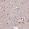 Transcription Factor AP-2 Delta antibody, PA5-61847, Invitrogen Antibodies, Immunohistochemistry frozen image 