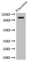 Rho GTPase Activating Protein 42 antibody, LS-C677184, Lifespan Biosciences, Western Blot image 