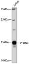 Prefoldin Subunit 4 antibody, 19-246, ProSci, Western Blot image 