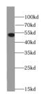 Cyclin Dependent Kinase 18 antibody, FNab06229, FineTest, Western Blot image 