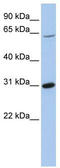 Fyn Related Src Family Tyrosine Kinase antibody, TA335031, Origene, Western Blot image 