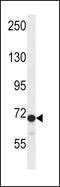 Dishevelled Segment Polarity Protein 2 antibody, LS-C167586, Lifespan Biosciences, Western Blot image 