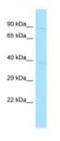 Hook Microtubule Tethering Protein 2 antibody, NBP1-98586, Novus Biologicals, Western Blot image 