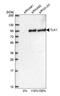 Tousled Like Kinase 1 antibody, NBP1-83035, Novus Biologicals, Western Blot image 