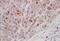 Aurora Kinase B antibody, NB100-294, Novus Biologicals, Immunohistochemistry frozen image 