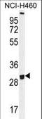 Olfactory Receptor Family 2 Subfamily B Member 11 antibody, LS-C163163, Lifespan Biosciences, Western Blot image 