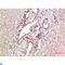 Transthyretin antibody, LS-C813256, Lifespan Biosciences, Immunohistochemistry paraffin image 