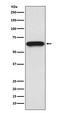 M-phase inducer phosphatase 2 antibody, M01899, Boster Biological Technology, Western Blot image 