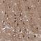 N-Terminal EF-Hand Calcium Binding Protein 3 antibody, HPA070595, Atlas Antibodies, Immunohistochemistry paraffin image 