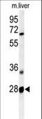 Receptor Transporter Protein 2 antibody, LS-C162807, Lifespan Biosciences, Western Blot image 