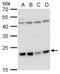 Leucine zipper and ICAT homologous domain-containing protein antibody, GTX120288, GeneTex, Western Blot image 