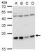 Leucine Zipper And CTNNBIP1 Domain Containing antibody, GTX120288, GeneTex, Western Blot image 