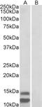 Cyclin Dependent Kinase Inhibitor 2B antibody, STJ72701, St John