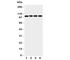 ADAM Metallopeptidase Domain 19 antibody, R31181, NSJ Bioreagents, Western Blot image 
